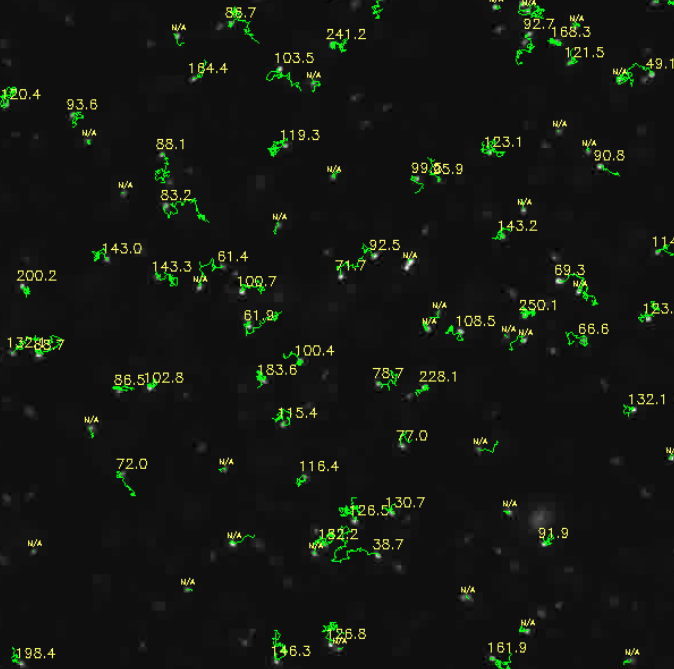 Blase software screenshot showing real-time ultrafine bubble tracking